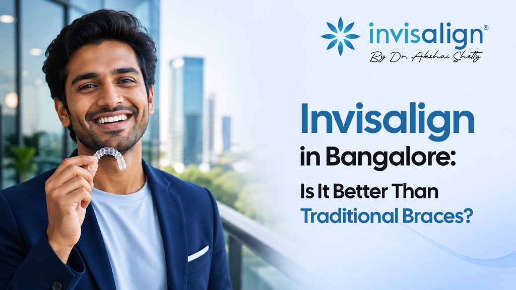 Invisalign treatment in Bangalore