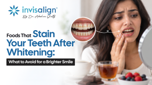 Foods That Stain Your Teeth After Whitening: What to Avoid for a Brighter Smile