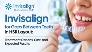 Invisalign for Gaps Between Teeth in HSR Layout: Treatment Options, Cost, and Expected Results
